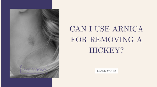 Can I Use Arnica for removing a hickey?