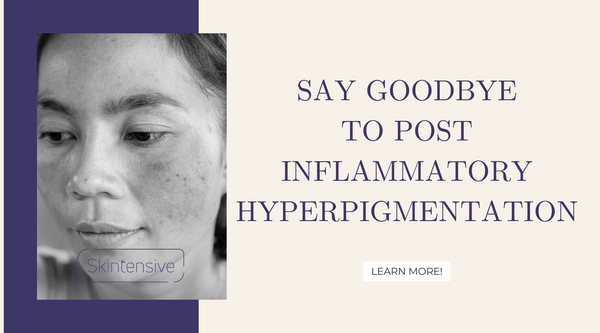 Say Goodbye to Post Inflammatory Hyperpigmentation: Effective Treatment and Management Strategies