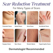 Silicone Scar Gel