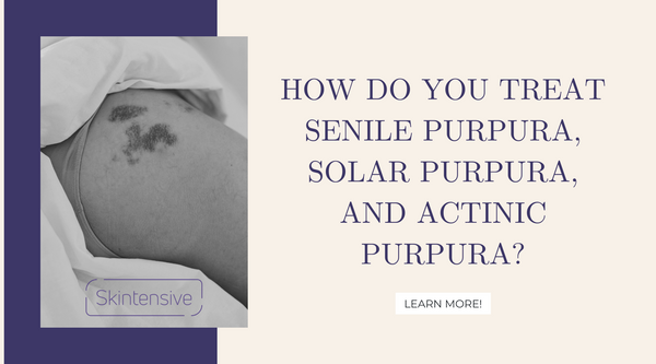 How do you treat senile purpura, solar purpura, and actinic purpura?