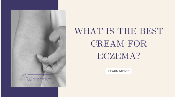 What Is The Best Cream For Eczema