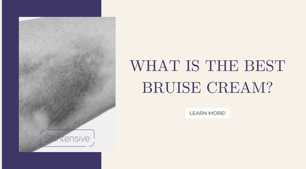 What is the best bruise cream?