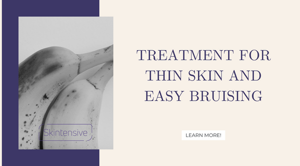 Treatment For Thin Skin And Easy Bruising