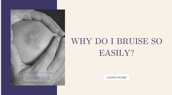 Why do I bruise so easily?