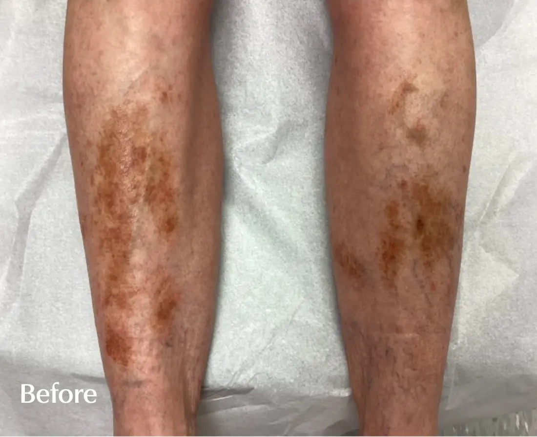 customer-leg-before.webp